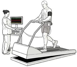 Man with electrodes on chest walking on treadmill for stress myocardial perfusion scan. Healthcare providor monitoring test.