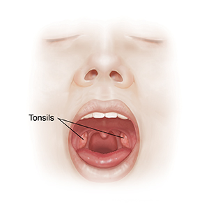Front view of face with open mouth showing oral cavity and tonsils.