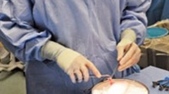 A surgeon prepares for a transplant surgery