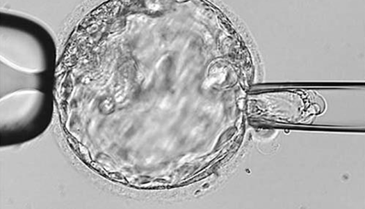 A microscopic view of an embryo A microscopic view of an embryo