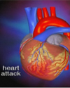 Launch Heart Attack Animation