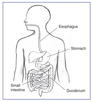 Esophagus and Stomach - Barnes-Jewish Hospital helicobacter pylori esophagus diagram 