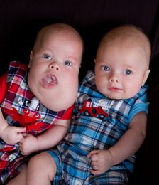 Caleb and Ben, ex utero intrapartum treatment (EXIT) patients